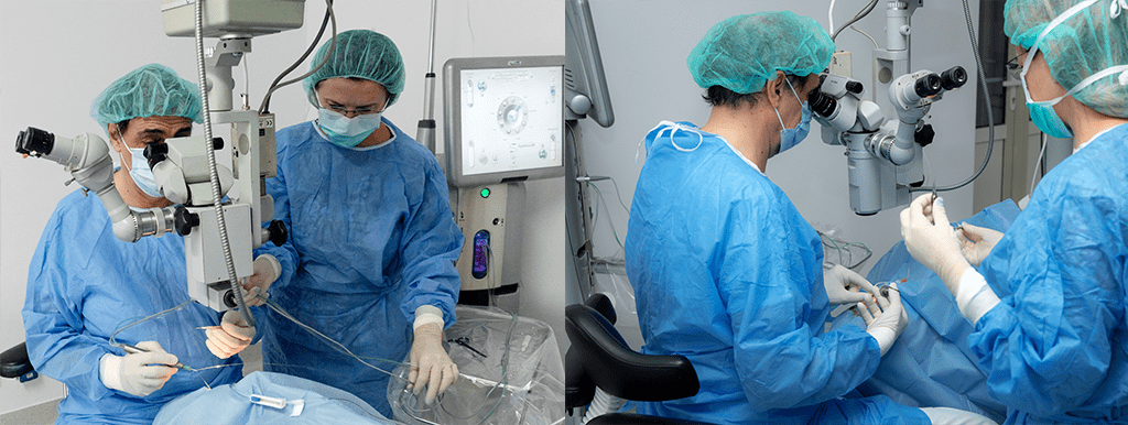chirurgia cataractei după operație vedere încețoșată)